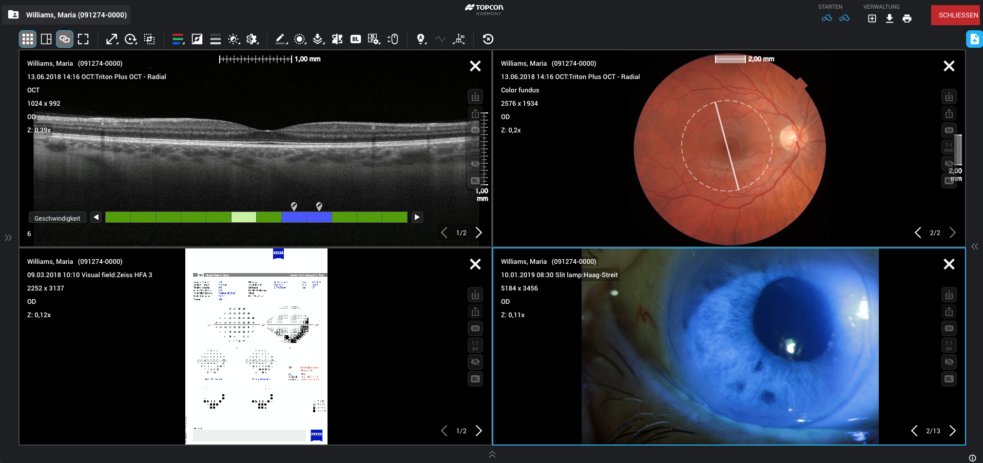 TOPCON Harmony